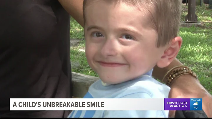 Gage Spurlock: Brittle Bone Disease