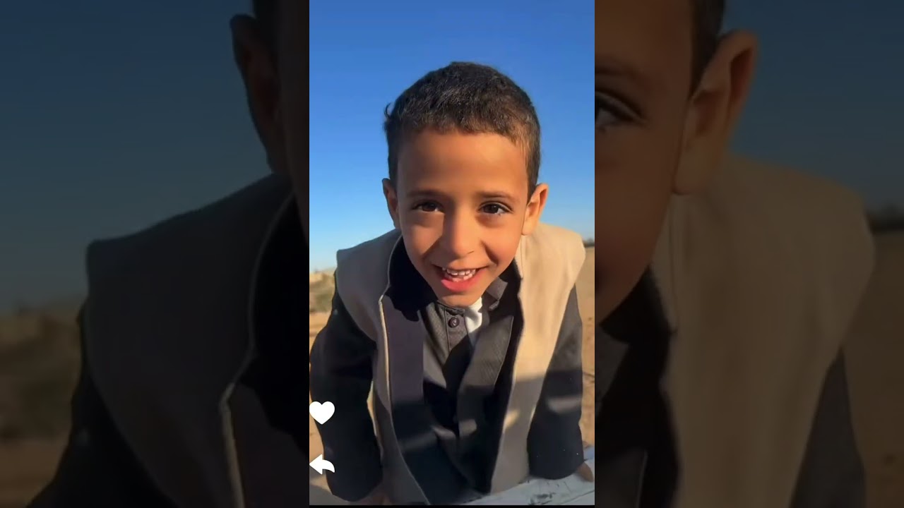 ابو قرون فيه جرح ولازم مخدر / سنابات ابو ناصر