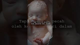 Download Lagu status wa power metal sadarku #musicindonesia #rock MP3