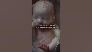 status wa power metal sadarku #musicindonesia #rock