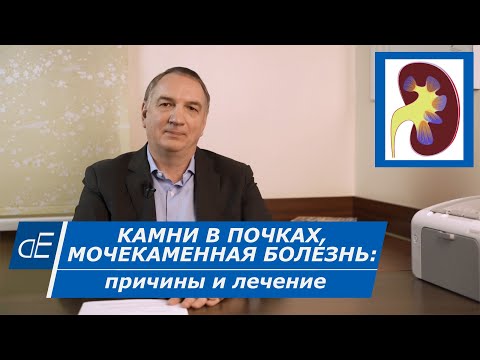 КАМНИ в ПОЧКАХ:  ЛЕЧЕНИЕ в домашних условиях. /  Мочекаменная болезнь, ПЕСОК в почках: что делать?