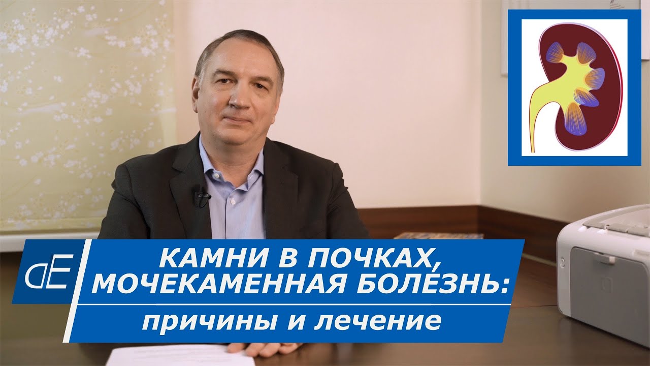 алкоголь при мочекаменной болезни