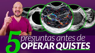 5 preguntas antes de operar quistes (Simple, Teratoma, Hemorrágico, Hipoecoico, SOP, Poliquístico)