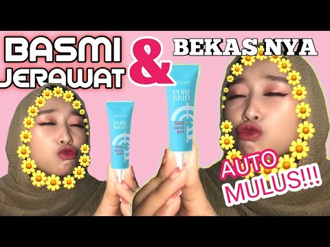 Hello Gaesss

Kali ini Ridwan balik lagi dengan #ReviewSkinCareOriflame untuk wajah berminyak atau t. 