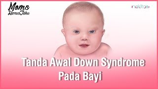 Tanda Awal Bayi yang Mengalami Down Syndrome