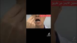 اعراض الايدز