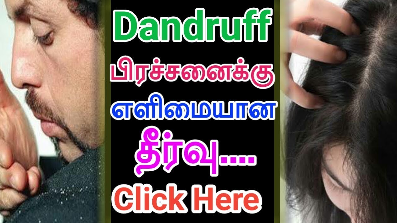 how to remove dandruff in tamil | home remedy to solve dandruff | podugu  nenga tips | reduce fast - YouTube