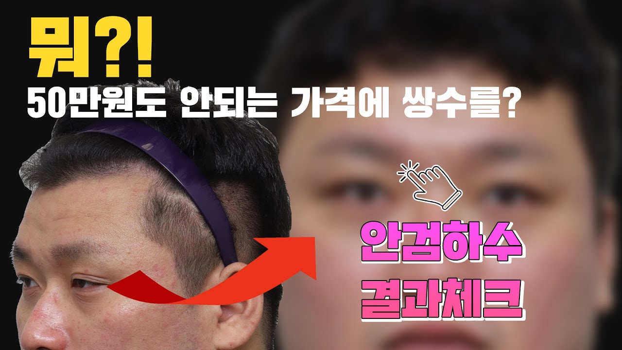 [Эйтоп Гоо Сайхны Мэс Заслын Эмнэлэг] "Ээжид хүүхэд нь нэн тэргүүнд байдаг учраас..." Сэтгэлд хоногшсон сэтгэл хөдөлгөм түүх [Нүдний зовхи унжилт-Эйтоп Гоо Сайхны Мэс Заслын Эмнэлэг/ATOP plastic surgery]