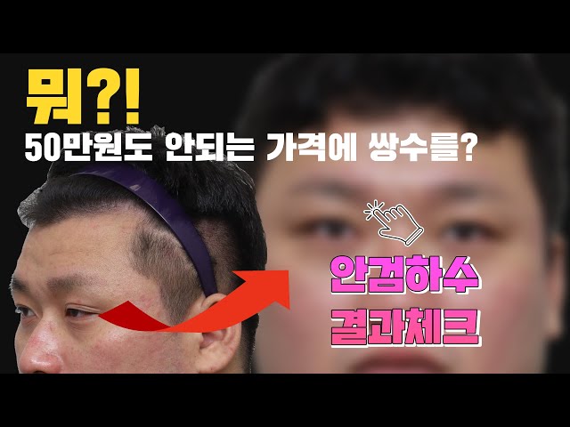 "엄마는 자식이 먼저니까.." 기억에 남는 감동 이야기 [안검하수-에이탑성형외과/ATOP plastic surgery]