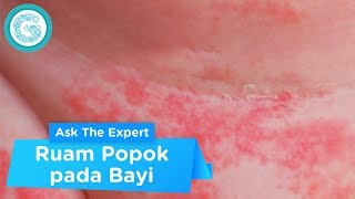 Waspada Ruam Popok Bayi, Ini Penyebabnya! - dr. Lucia Nauli Simbolon, Spa