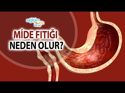 Mide Fıtığının Nedenleri Nelerdir?