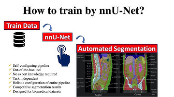 nnU-Net: How to Train? (Ep.2/3)