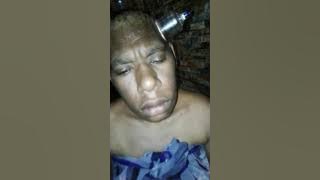 Bekam kepala papua Wamena