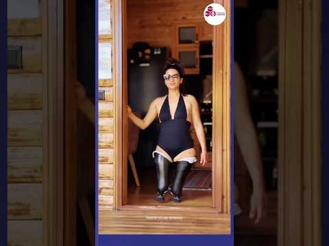 Happiness After Amputation Walking onProsthetic Limbs Life After Amputation Inspiring Woman Walks