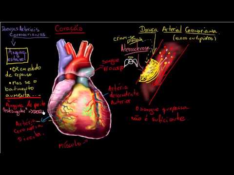 Vídeo: 11 Maneiras De Prevenir A Doença Arterial Coronariana