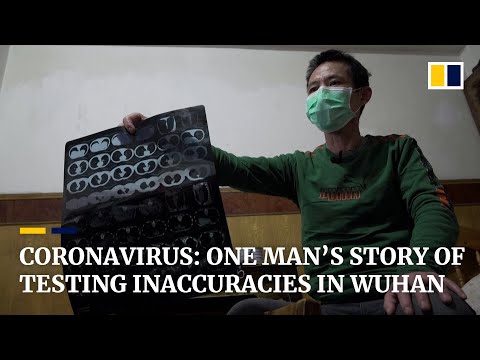 One Wuhan patient’s story of repeatedly testing false negative for coronavirus