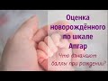 Оценка новорождённых по шкале Апгар / Шкала Апгар в роддоме