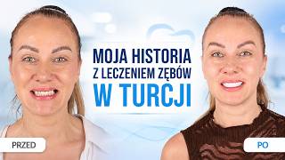 Dlatego zdecydowałam się leczyć zęby w Turcji - Moja historia