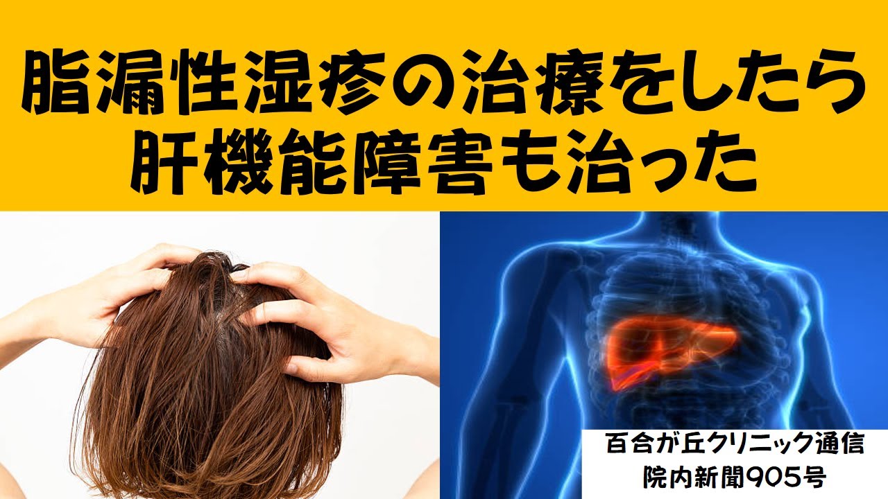 肝臓 と 湿疹