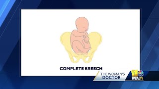 Can a 'breech' baby correct itself before birth?
