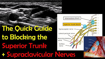 SUPERIOR TRUNK BLOCK - A 5-Minute "How-To" Guide