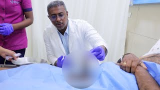 Rigicon Malleable Penile Implant Surgery | First Day Pack Removal