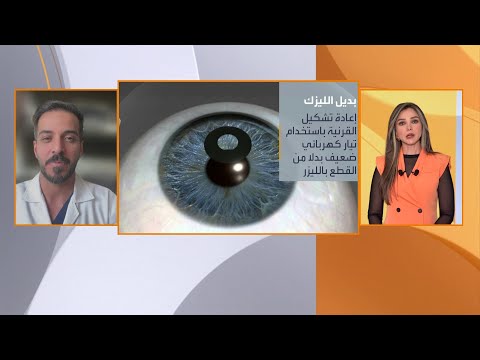 علاجات ثورية.. تصحيح النظر بالتيار الكهربائي بدل الليزك