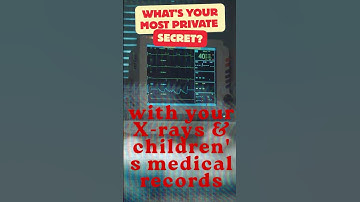 Massive Healthcare Data Breach Exposes Millions | KillSec Supply Chain Attack Alert #shorts #infosec