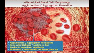 Decoding Red Blood Cell Morphology: Mastering Peripheral Blood Smears & Indices