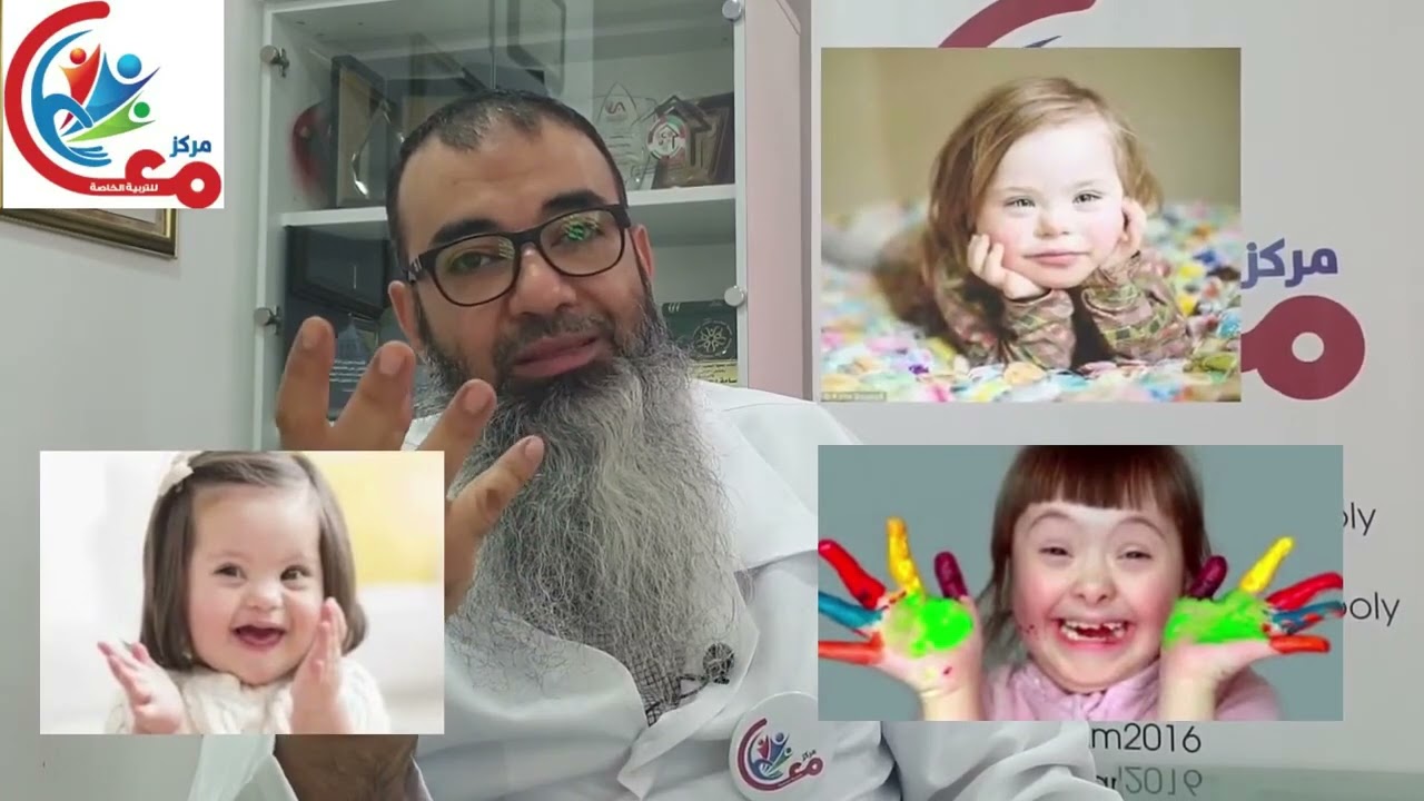 #سلسلة_أبشر1- تصنيفات اخرى لمتلازمة داون Down_syndrome من المهم معرفتها | مع #اسامة_مدبولي