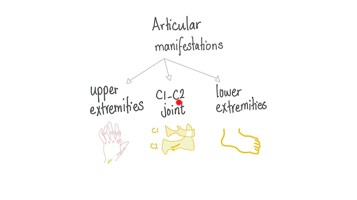 Rheumatoid Arthritis (Part 4): Clinically, Articular manifestations - DayDayNews