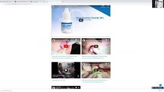 How I Use Silver Diamine Fluoride in my Mobile Practice