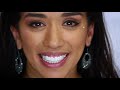 No Dentist? No Problem! Teeth Whitening Dental Veneers Are The Key to A Gummy Smile Correction