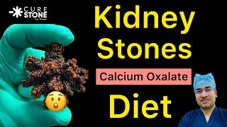 Diet In Case Of Calcium Oxalate Kidney Stones? What To Eat On Calcium Oxalate Diet