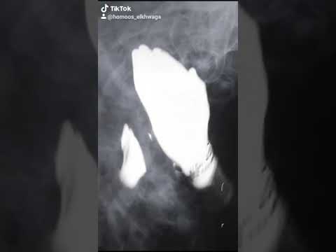 فاتح بيبان اي عراك مرجعش خطوه تسحب سلاح انتا وهواك هفرك المطوه تيك توك Homoos Elkhwaga