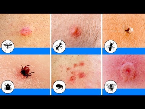 تصویری: Mosquitall از پشه ها: اسپری ، مایع و صفحات بخور در سوکت ، مارپیچ و کرم ، وسایل دیگر. دستورالعمل ها ، مرورها را مرور کنید