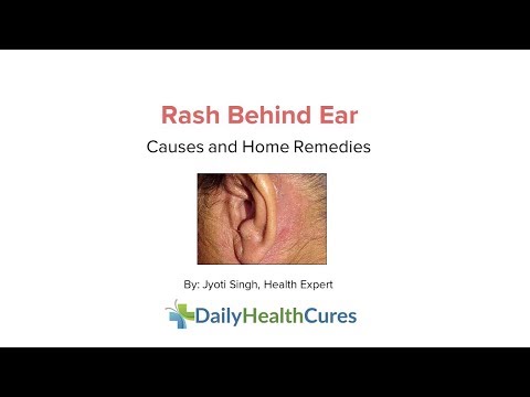 Rash behind Ear: 10 Possible Causes and Home Remedies