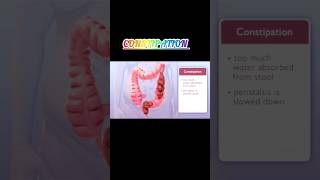 Constipation - 3d animation  #meded #anatomy #3dmodel