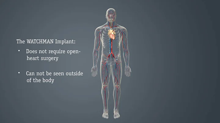 Cardiovascular WATCHMAN™ to Reduce AFib Stroke Risk
