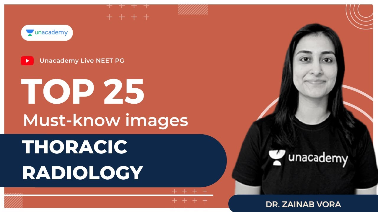 Top 25 must-know images | Thoracic Radiology | Dr. Zainab Vora