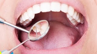 Brushing teeth daily linked to better heart health: Study