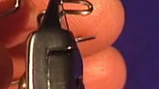 Ricketts Labial Bow Adjustment