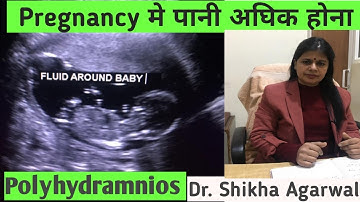 Polyhydramnios/Pregnancy प्रेग्नेंसी में बच्चों के चारो और अधिक पानी होना/drshikhaagarwal