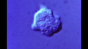 Como ocorre a transmissão por Naegleria fowleri?