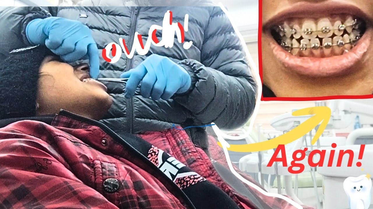 Видеоблог о подтягивании брекетов | Тяжёлая драма + Реальность