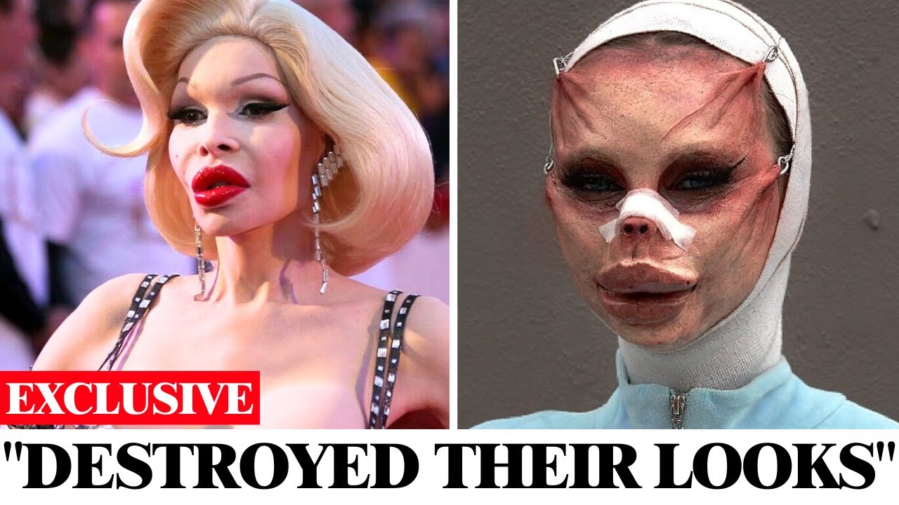 Hollywood Stars Who Destroyed Their Looks With Plastic Surgery Regrets  Then And Now 2025