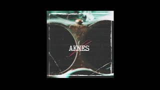 AKNES - KARABINA (prod.SICKSPLUSS)