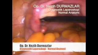 Diagnostik Laparoskopi, Normal Anatomi
