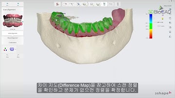 3DBioCAD -  3Shape Implant Studio 소개 및 시연
