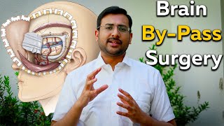 Brain By Pass Surgery | Dr. Hariharasudan Ranganathan